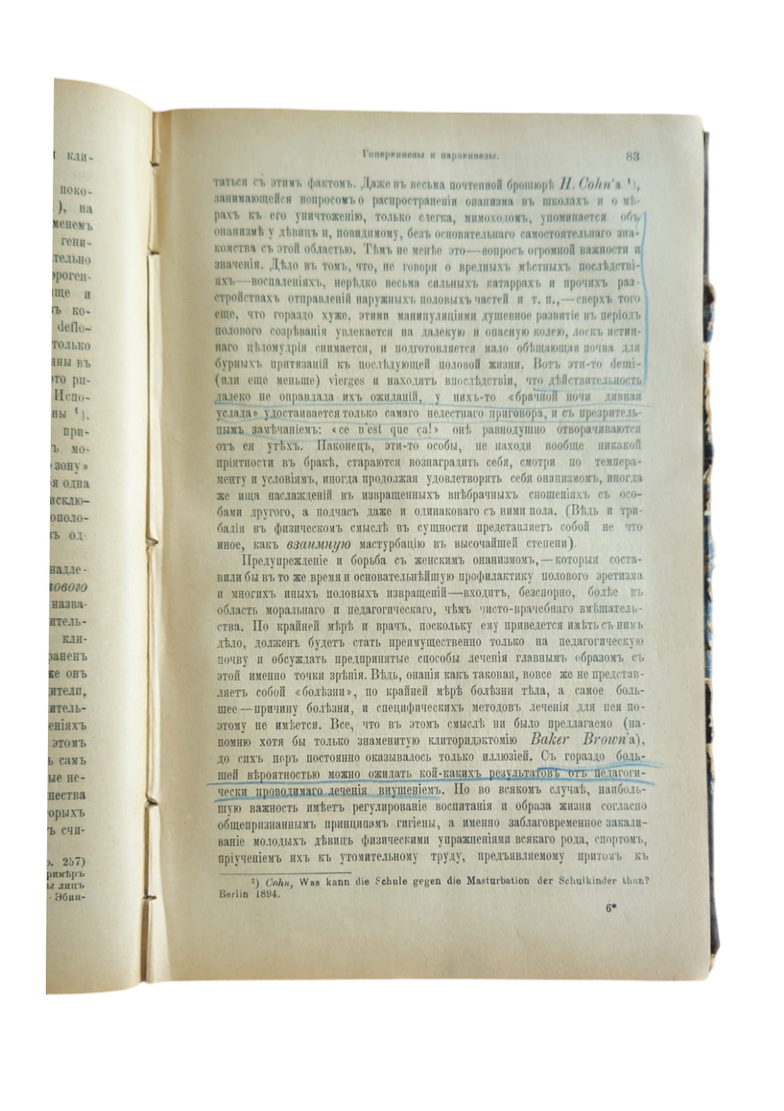 Половая невропатия — изображение 3